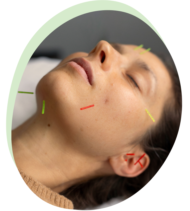 Facial Rejuvenation Acupuncture